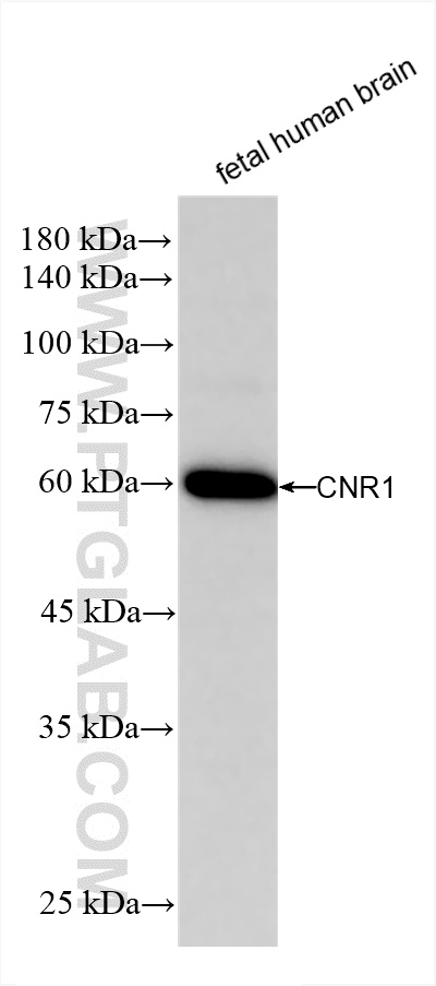 WB analysis of fetal human brain using 82787-2-RR (same clone as 82787-2-PBS)