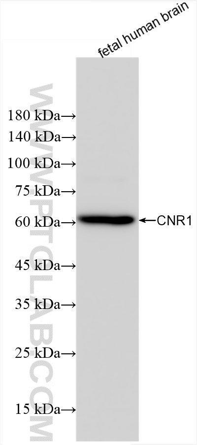 WB analysis of fetal human brain using 82787-3-RR (same clone as 82787-3-PBS)