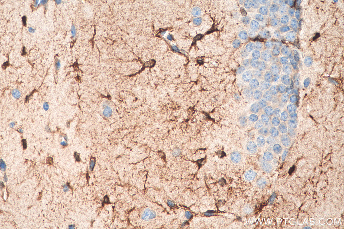 IHC staining of mouse brain using 29371-1-AP