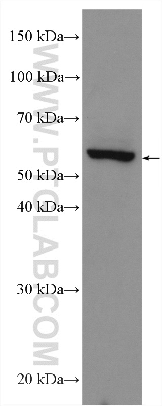 WB analysis of MCF-7 using 29371-1-AP