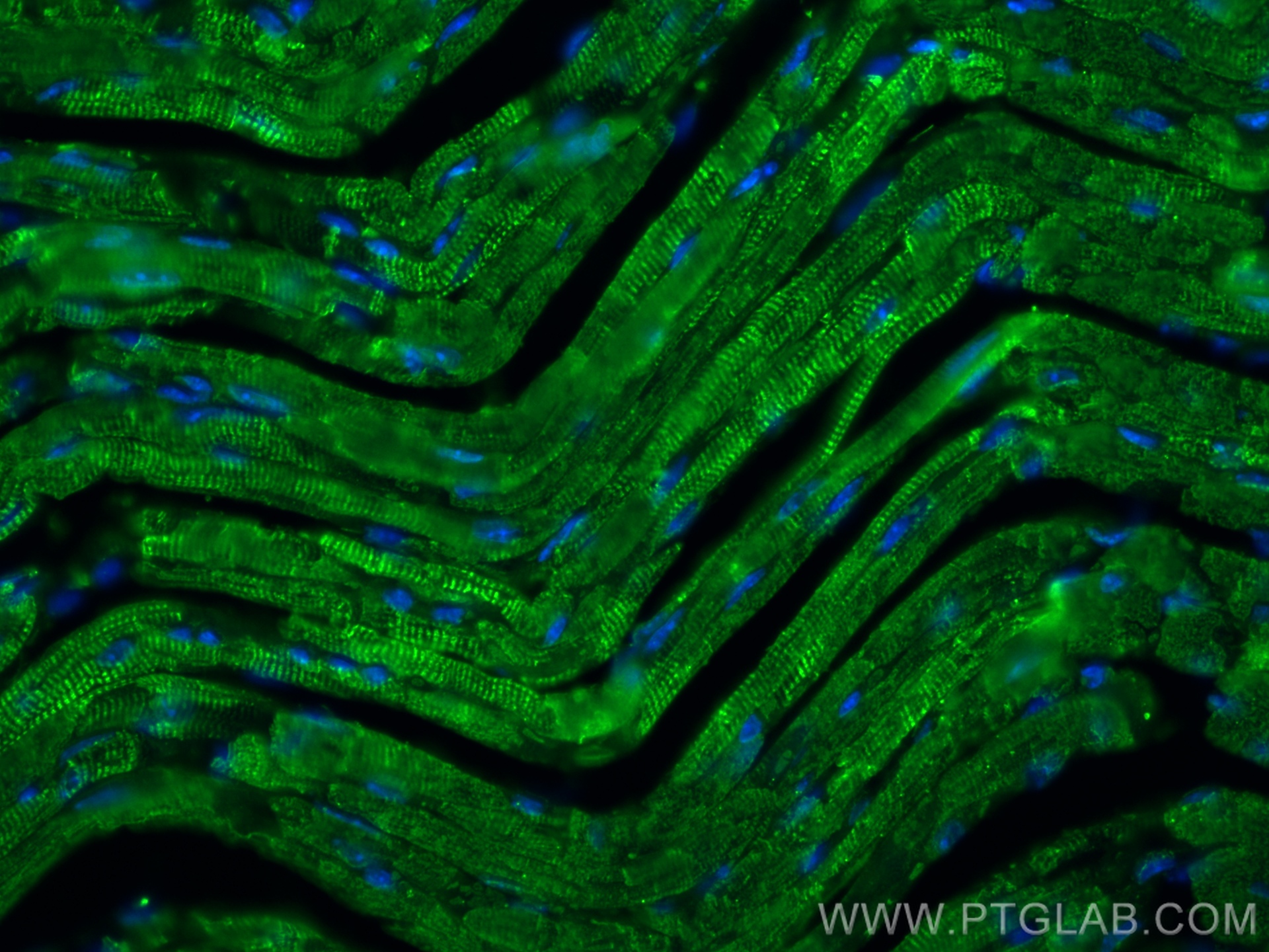 IF Staining of mouse heart using 66376-1-Ig (same clone as 66376-1-PBS)