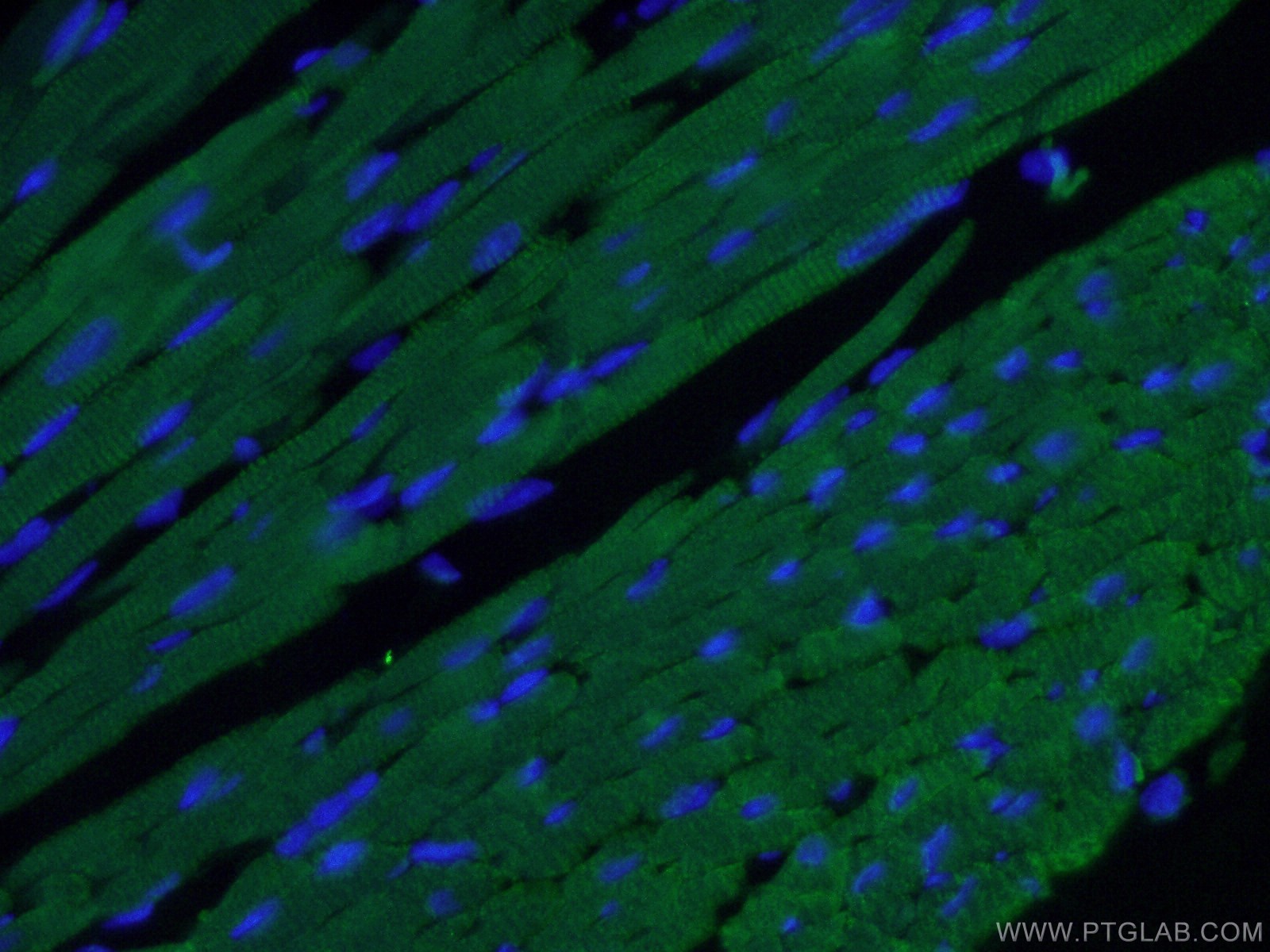 IF Staining of mouse heart using 66376-1-Ig (same clone as 66376-1-PBS)