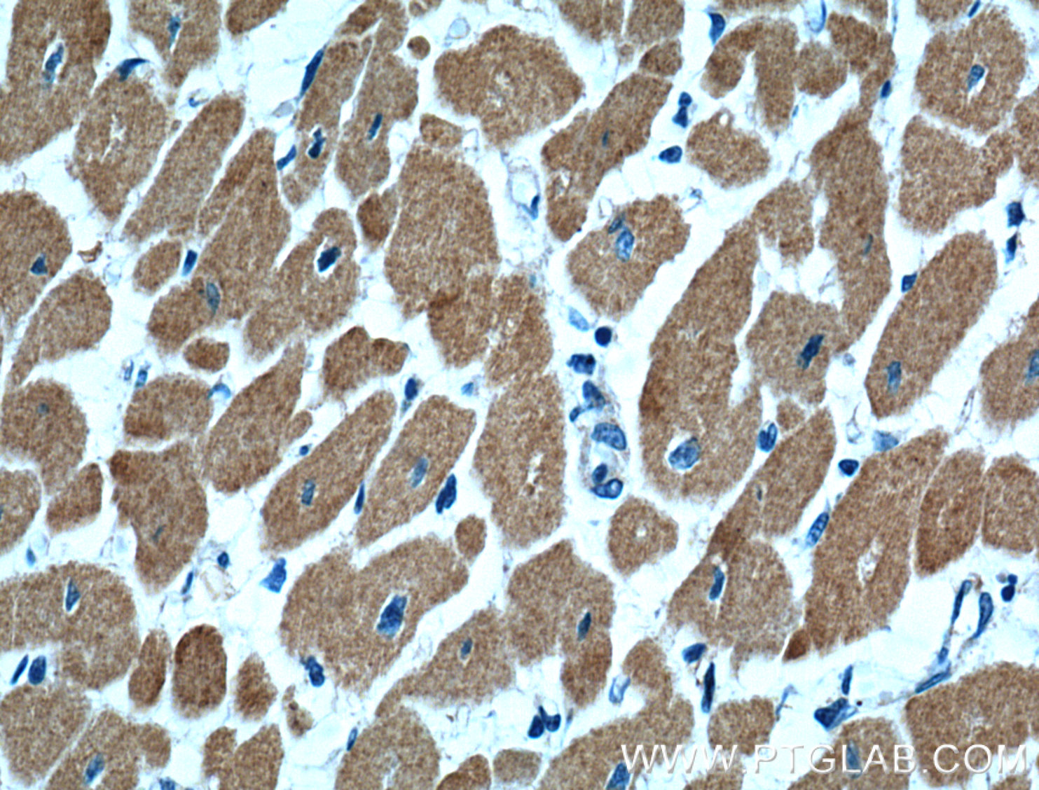 IHC staining of human heart using 66376-1-Ig (same clone as 66376-1-PBS)