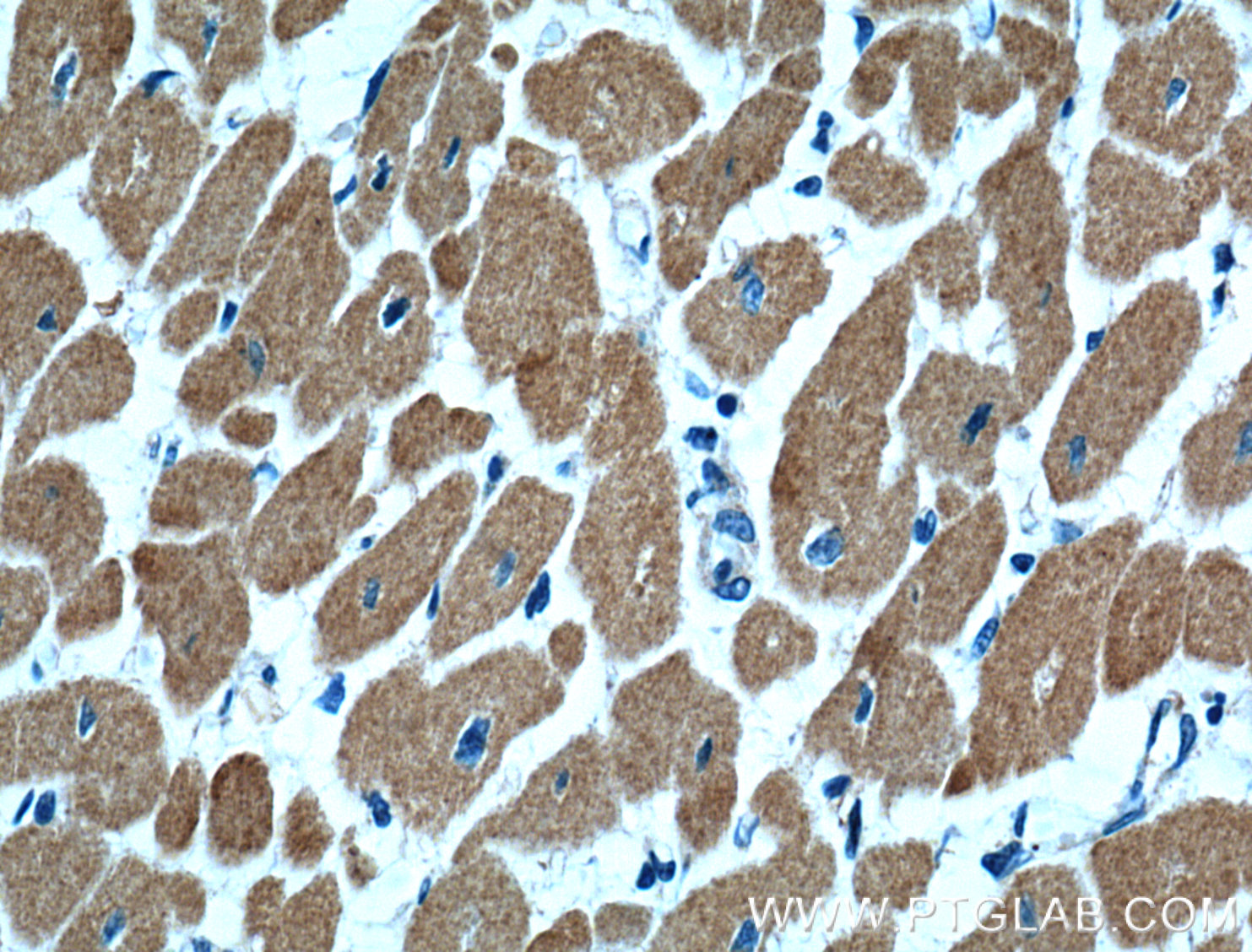 IHC staining of human heart using 66376-1-Ig