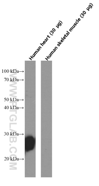 WB analysis of human heart using 66376-1-Ig