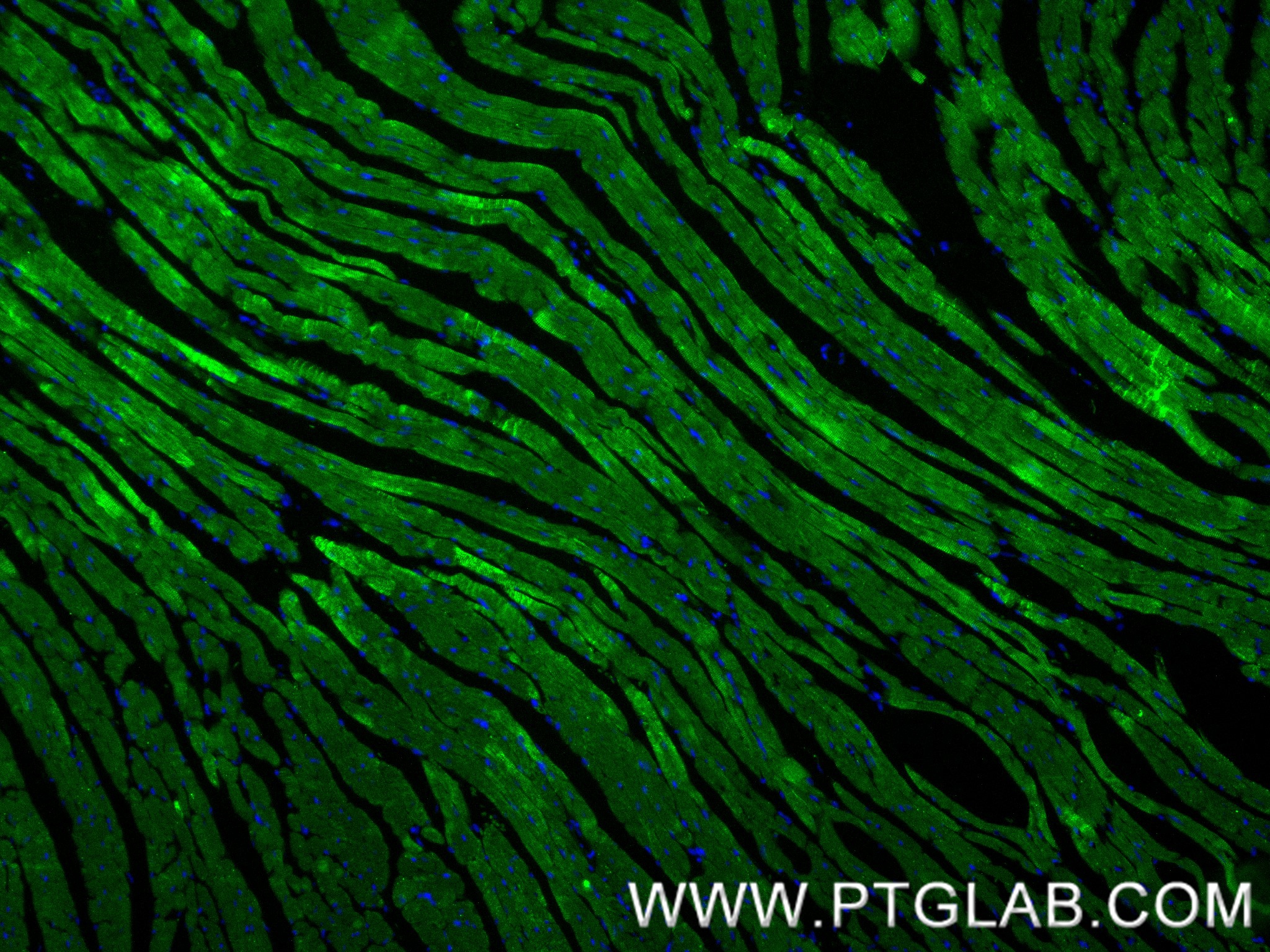 IF Staining of mouse heart using 86791-1-RR IF Staining of mouse heart using 86791-1-RR