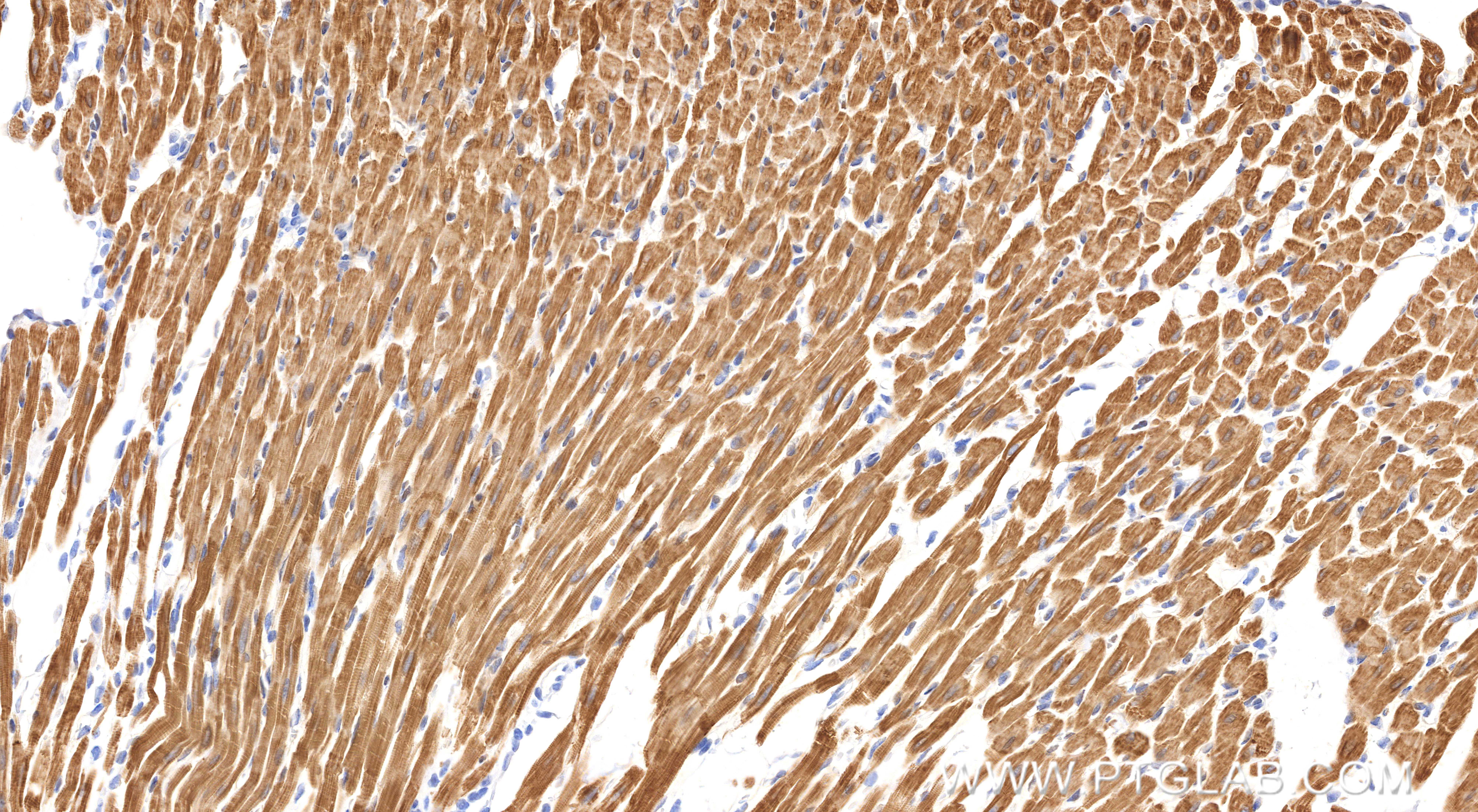 IHC staining of rat heart using 86791-1-RR IHC staining of rat heart using 86791-1-RR