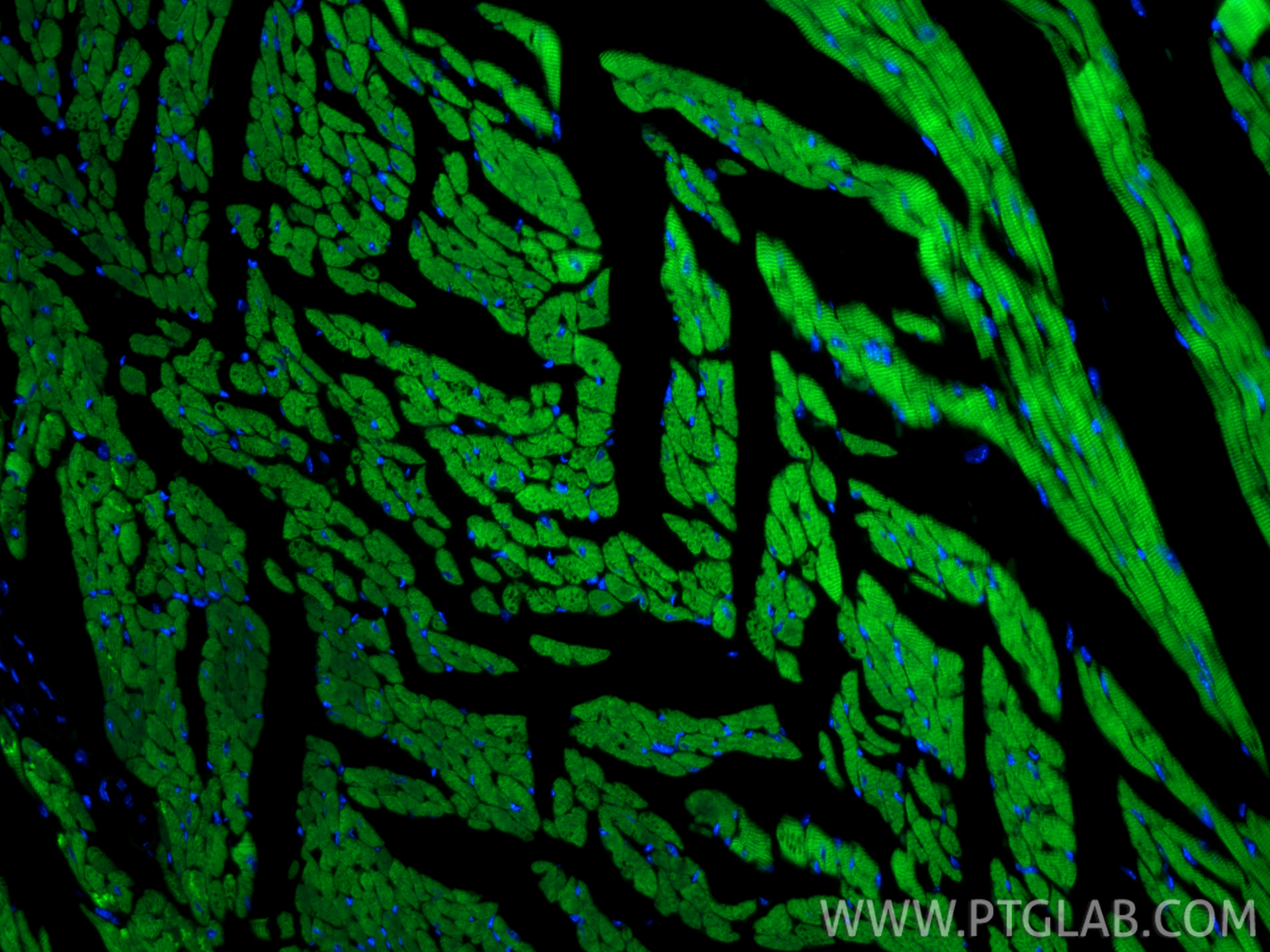 IF Staining of mouse heart using CL488-86791 IF Staining of mouse heart using CL488-86791