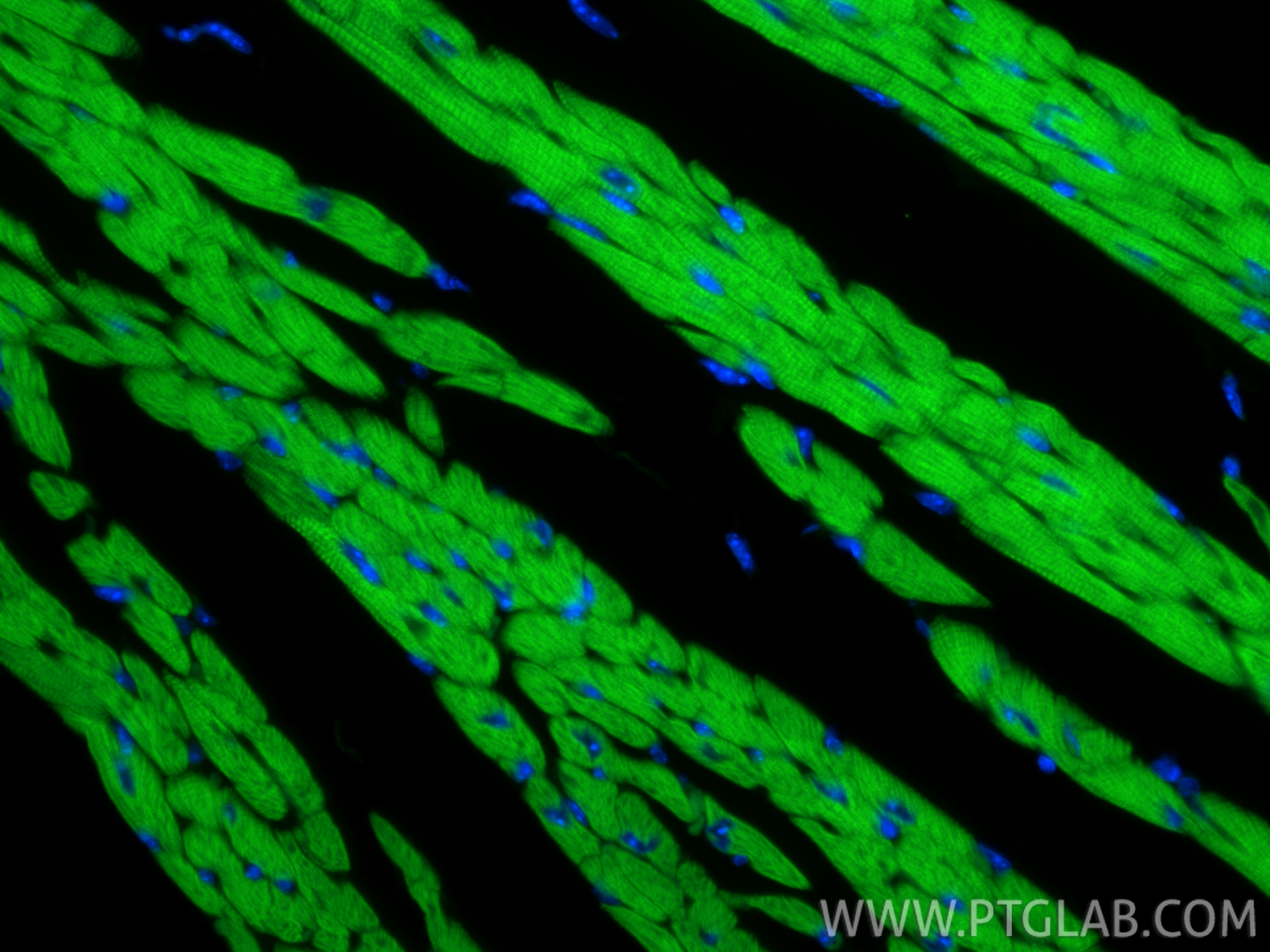 IF Staining of mouse heart using CL488-86791 IF Staining of mouse heart using CL488-86791