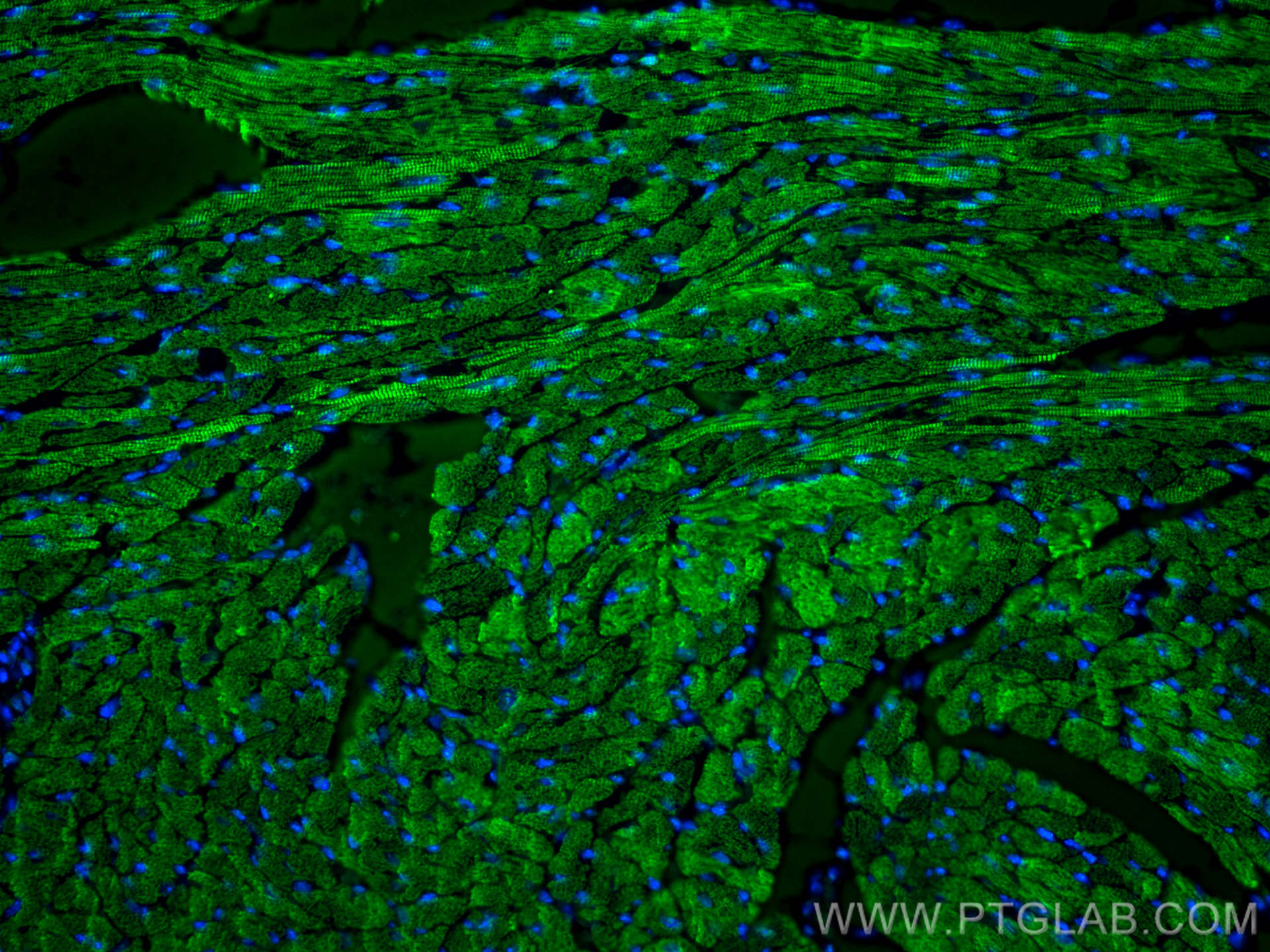 IF Staining of mouse heart using 26592-1-AP