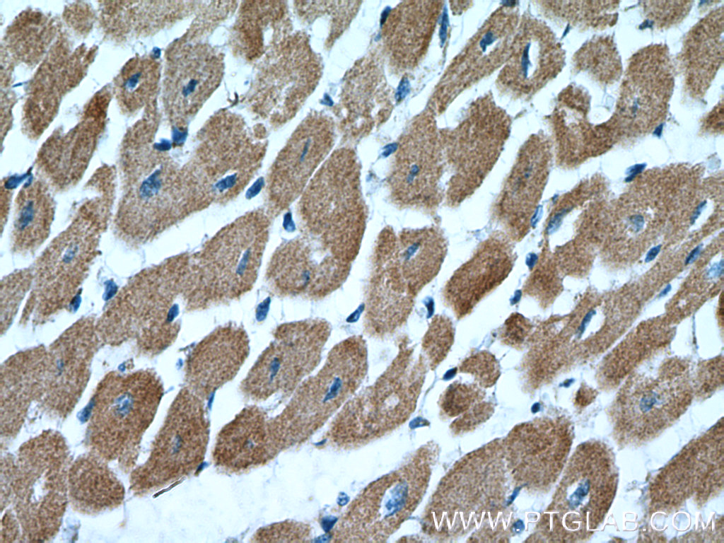 IHC staining of human heart using 26592-1-AP