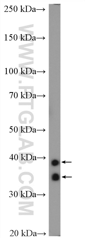 Cardiac Troponin T