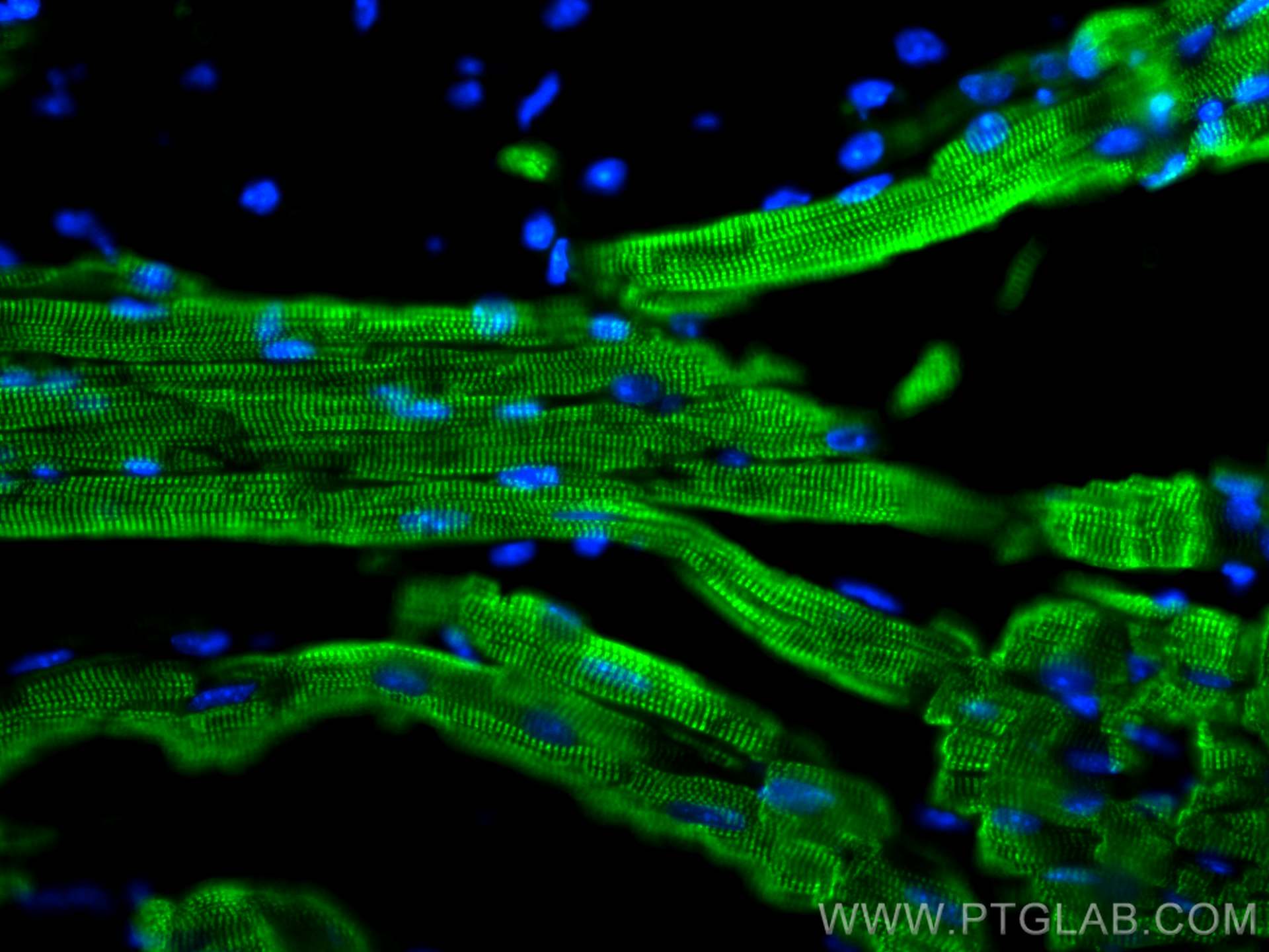 IF Staining of mouse heart using 68300-1-Ig (same clone as 68300-1-PBS)