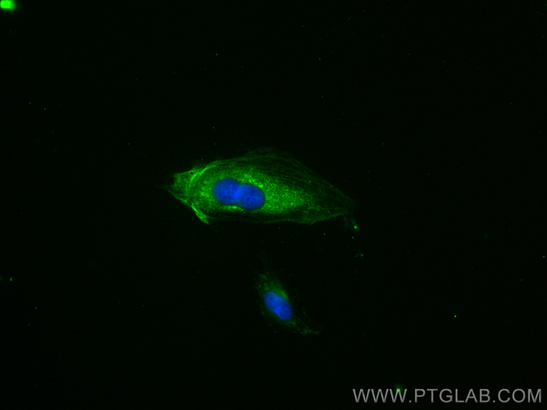 Cardiac Troponin T