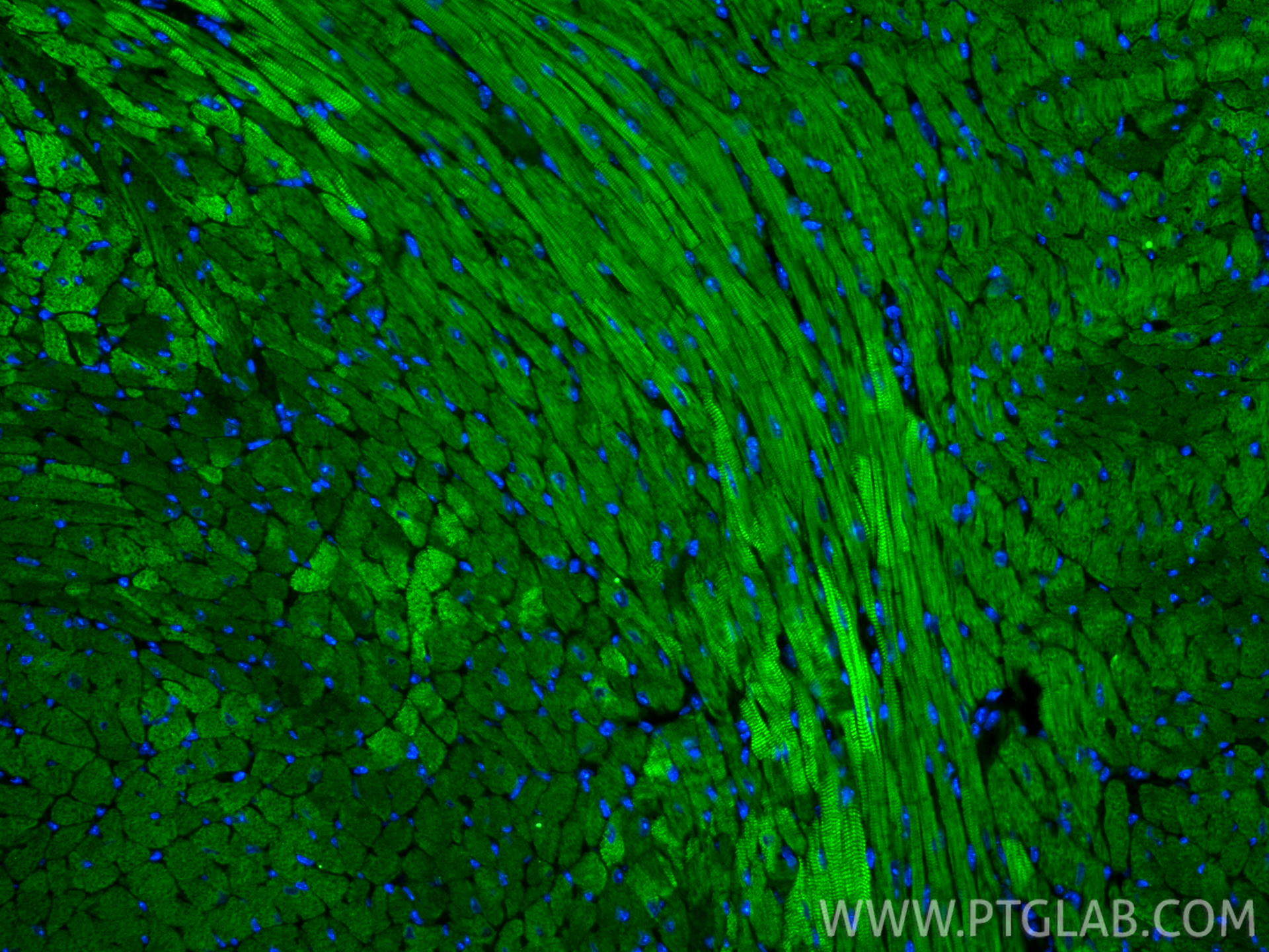 IF Staining of mouse heart using CL488-68300 IF Staining of mouse heart using CL488-68300