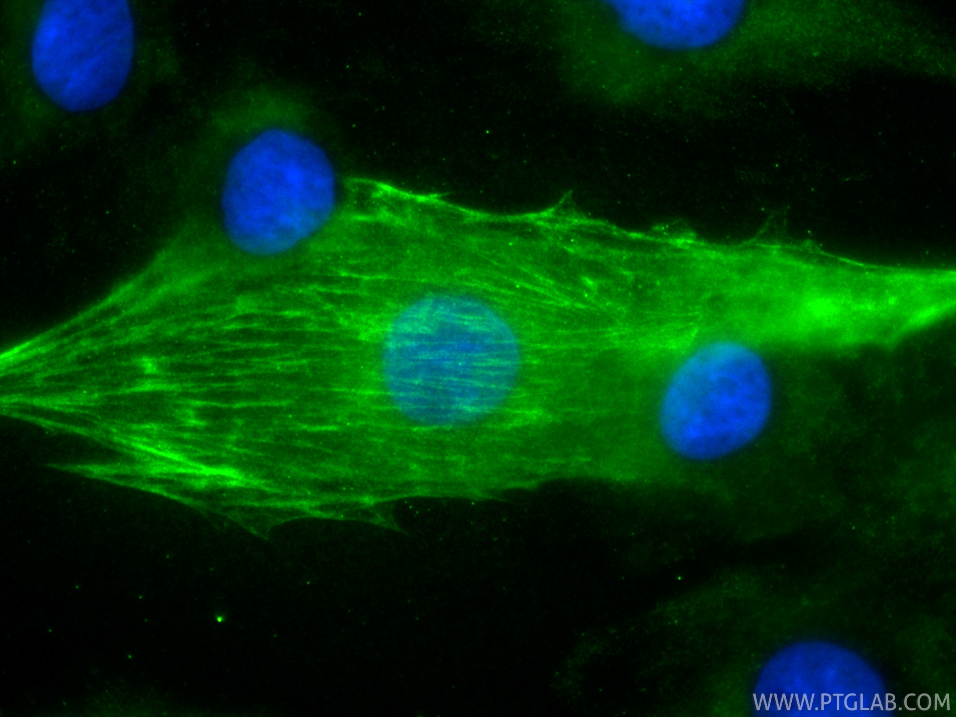 IF Staining of H9C2 using CL488-68300 IF Staining of H9C2 using CL488-68300