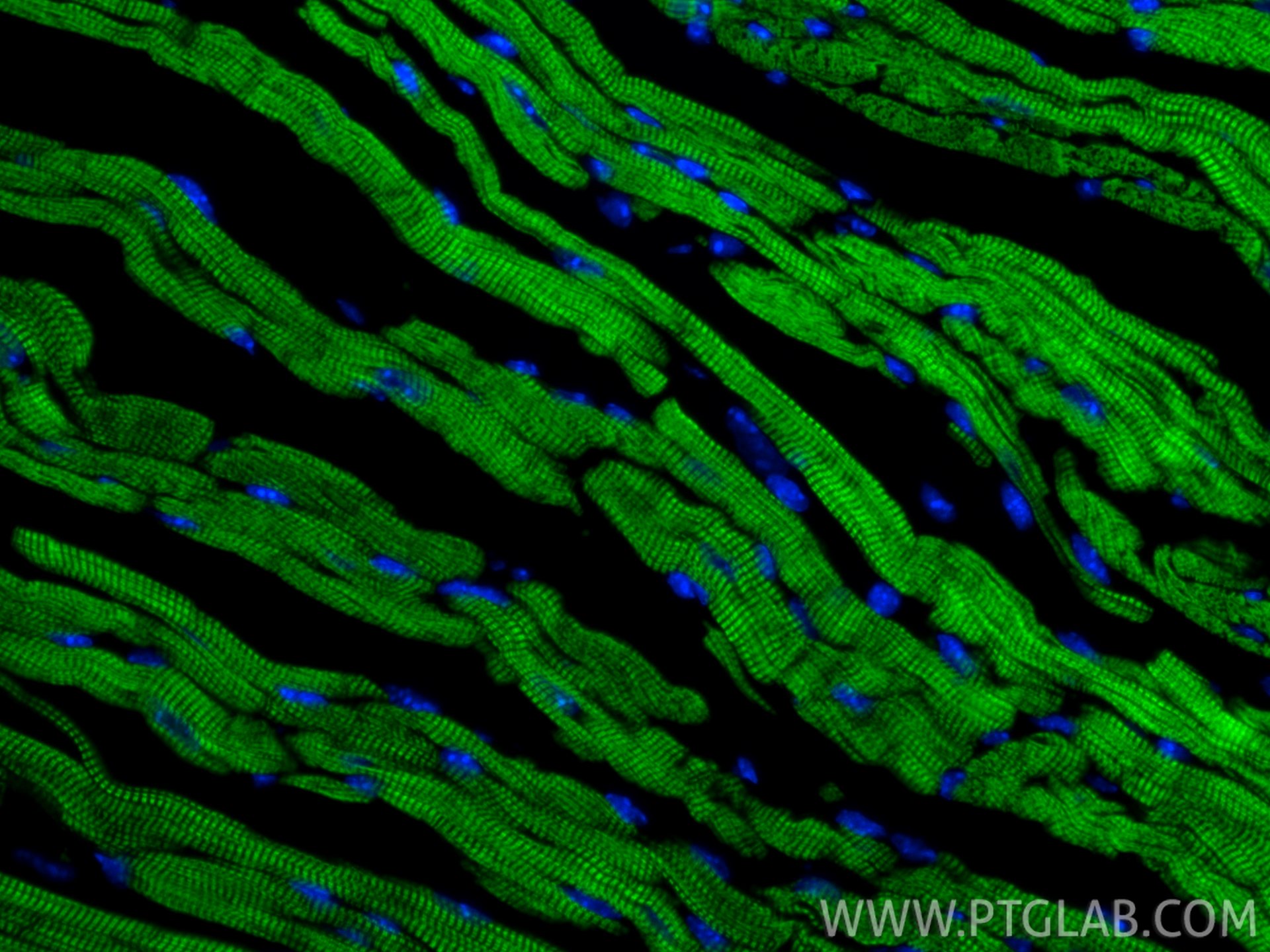 IF Staining of mouse heart using CL488-81638-3