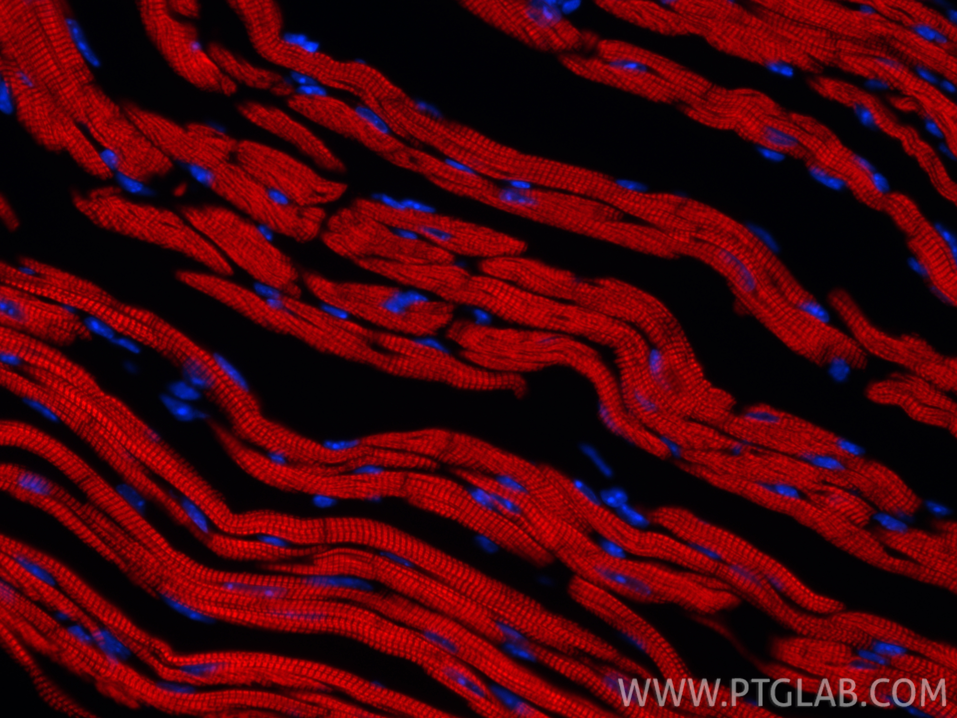 IF Staining of mouse heart using CL594-81638-3