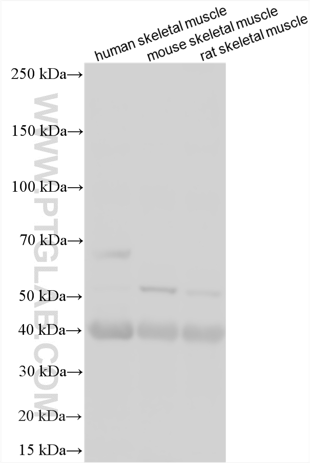 WB analysis using 31020-1-AP WB analysis using 31020-1-AP