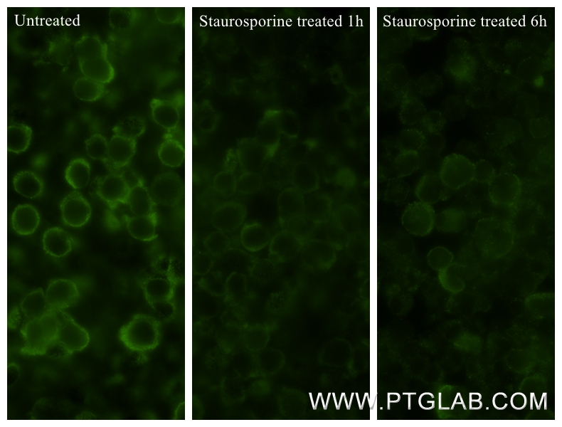 IF Staining of Jurkat using 85196-3-RR (same clone as 85196-3-PBS)