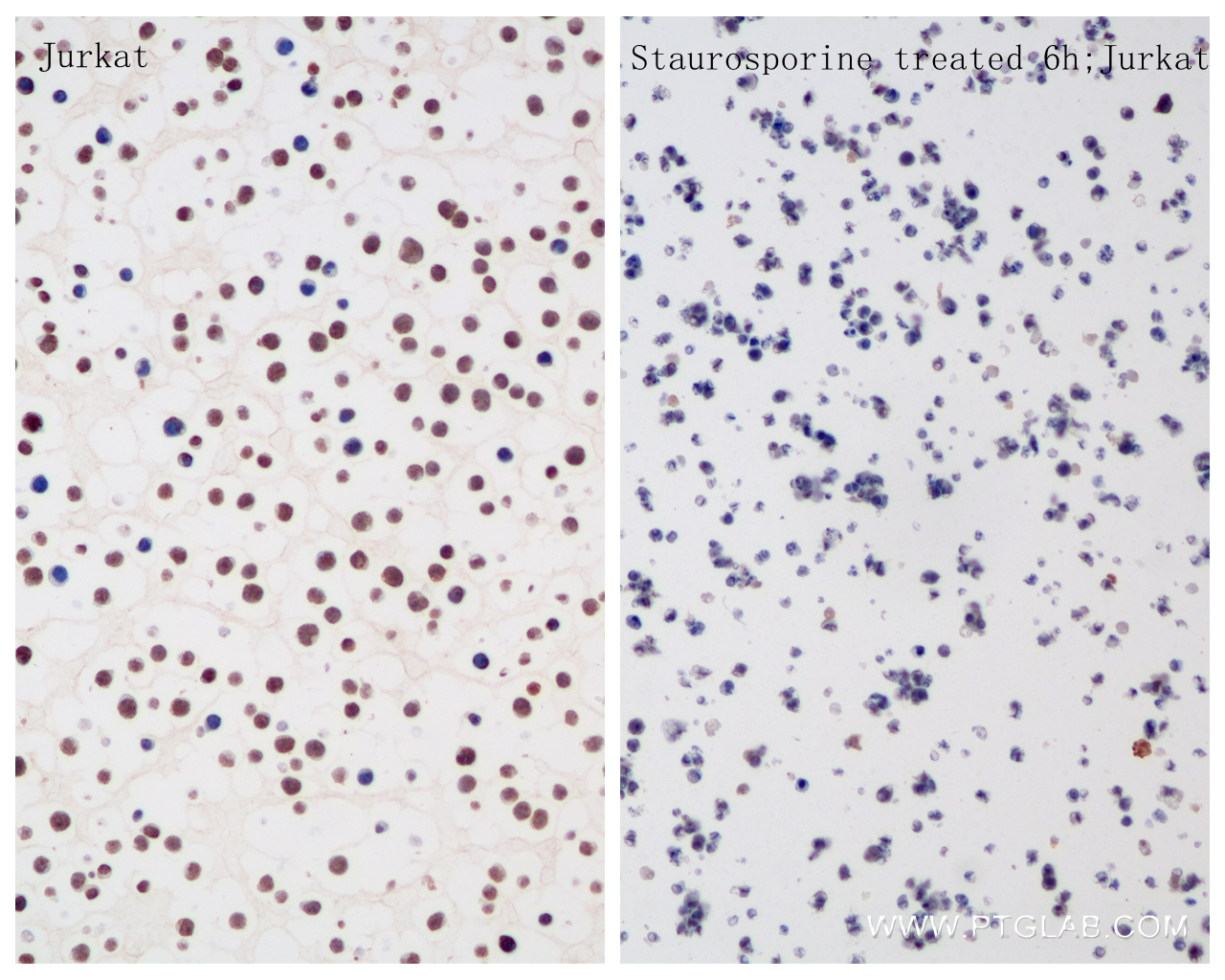 IHC staining of Jurkat using 85196-3-RR