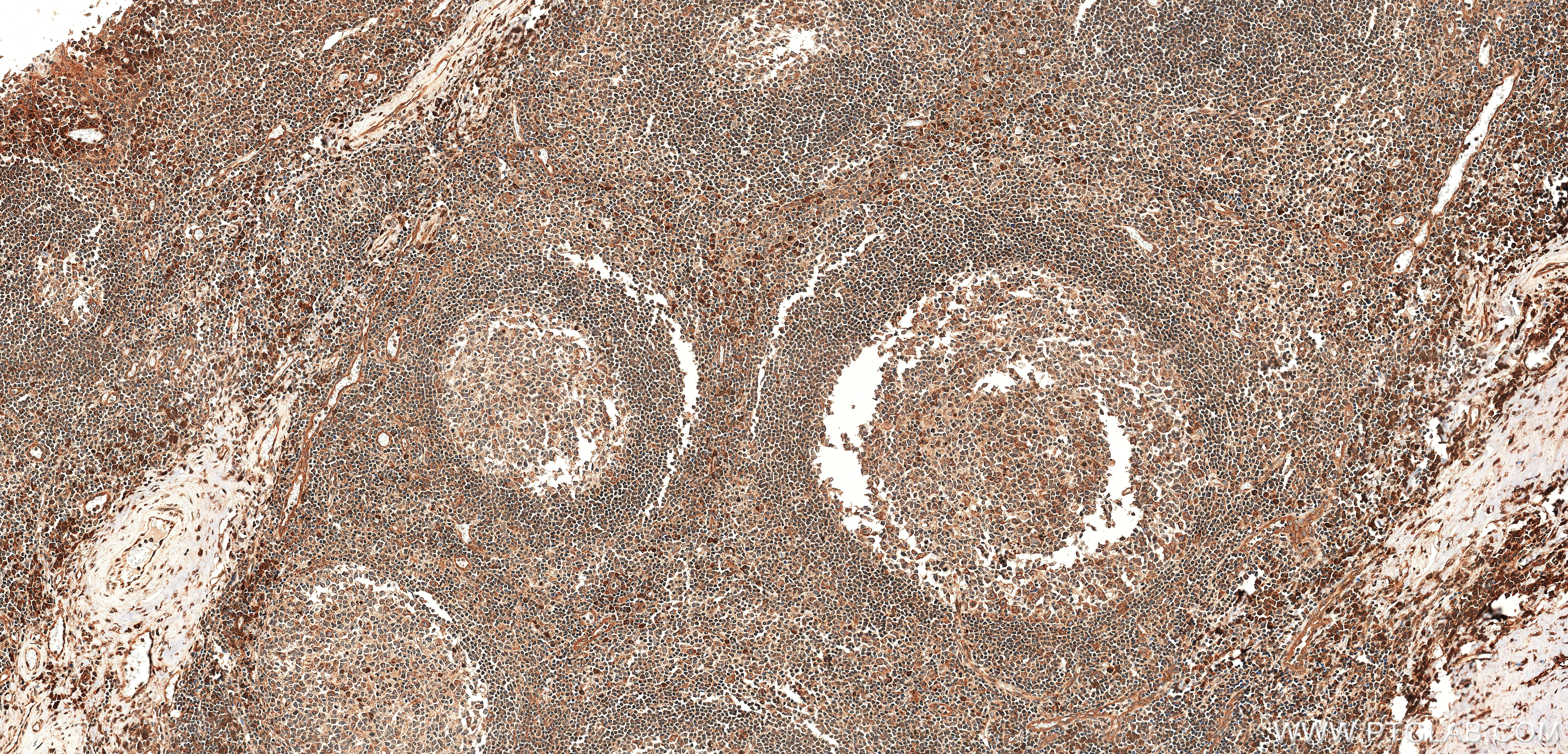 IHC staining of human tonsil using 85196-3-RR IHC staining of human tonsil using 85196-3-RR