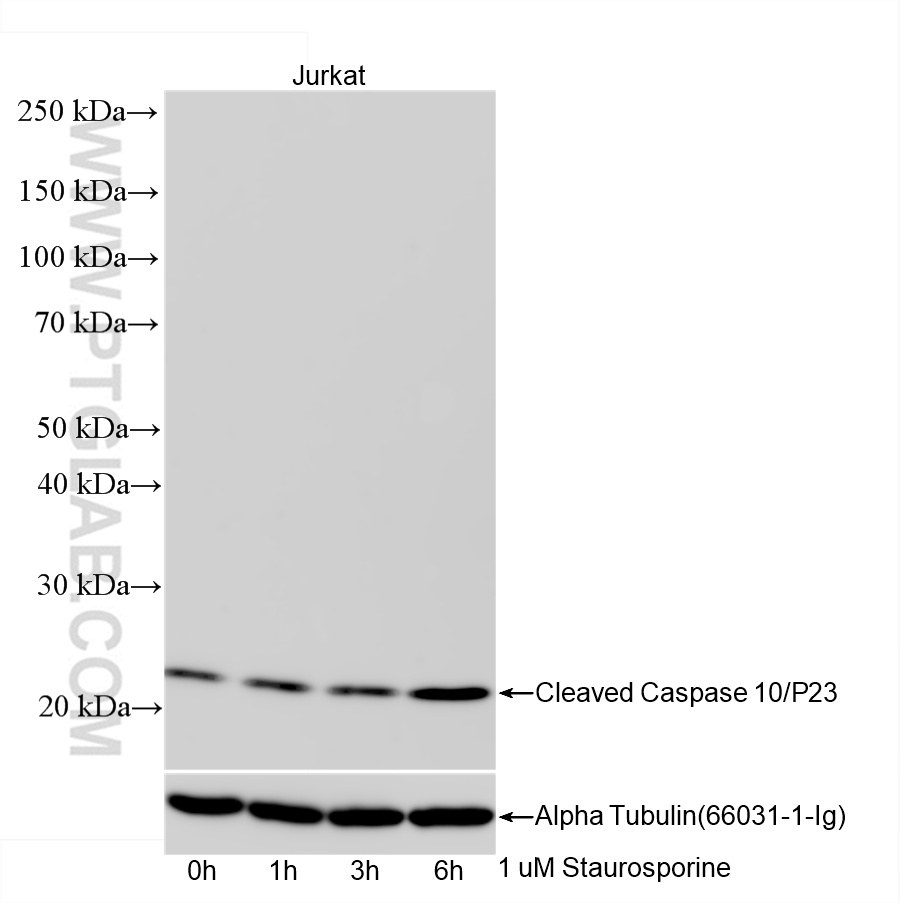 WB analysis of Jurkat using 85104-3-RR (same clone as 85104-3-PBS)