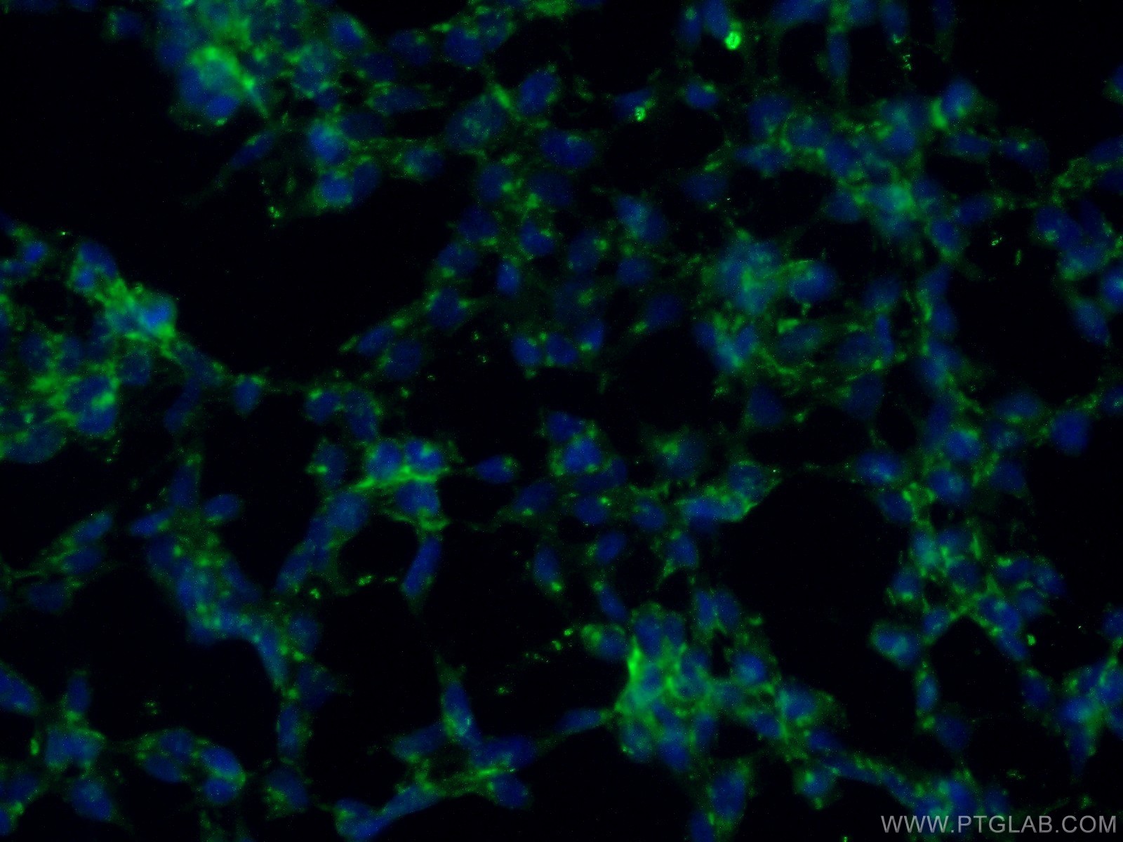 IF Staining of HEK-293 using 24777-1-AP