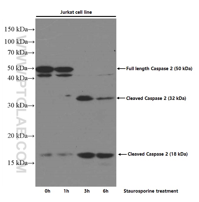 WB analysis of Jurkat using 66517-1-Ig