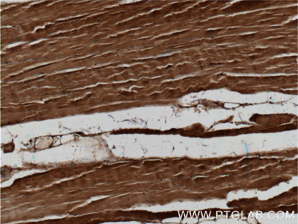 IHC staining of human skeletal muscle using 25546-1-AP