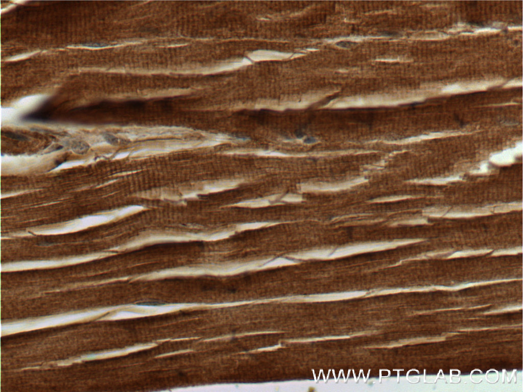 IHC staining of human skeletal muscle using 25546-1-AP
