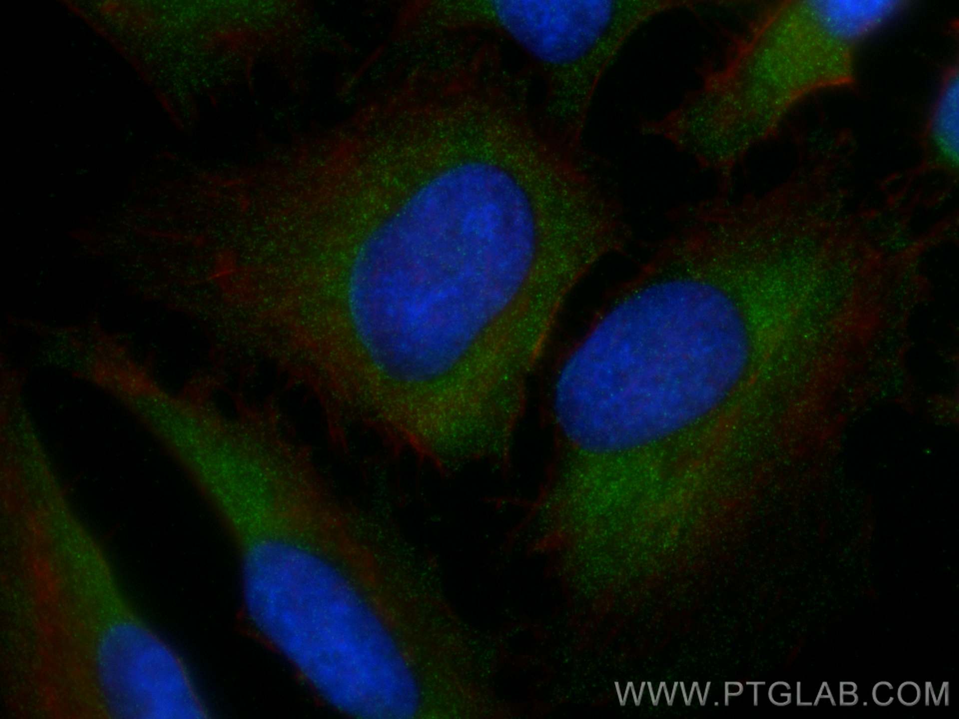 IF Staining of HeLa using 82202-1-RR (same clone as 82202-1-PBS)