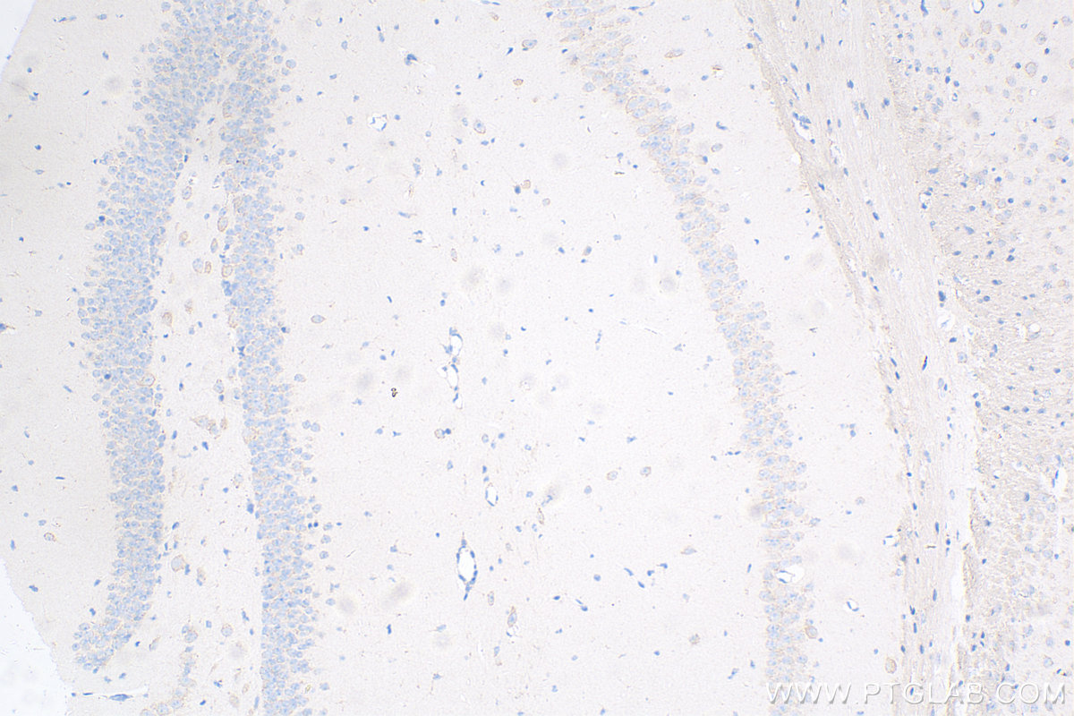 IHC staining of mouse brain using 82202-1-RR (same clone as 82202-1-PBS)