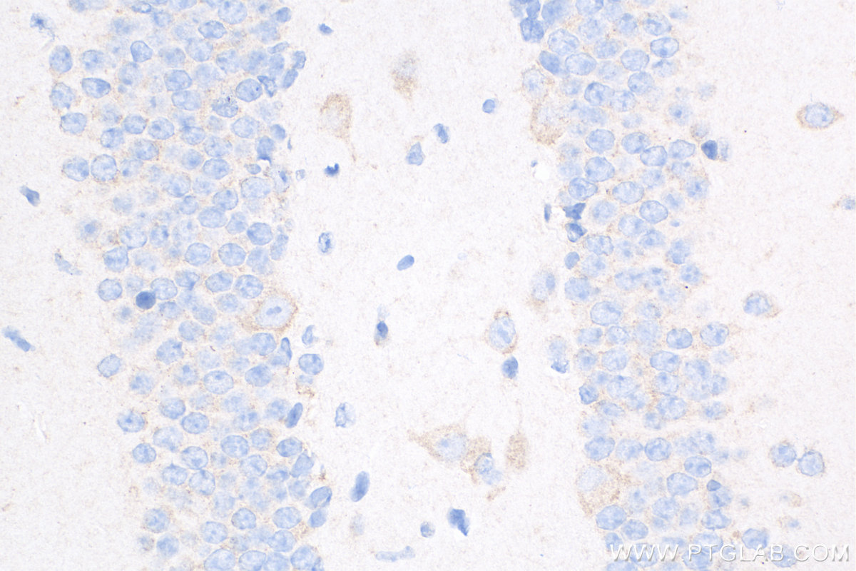 IHC staining of mouse brain using 82202-1-RR