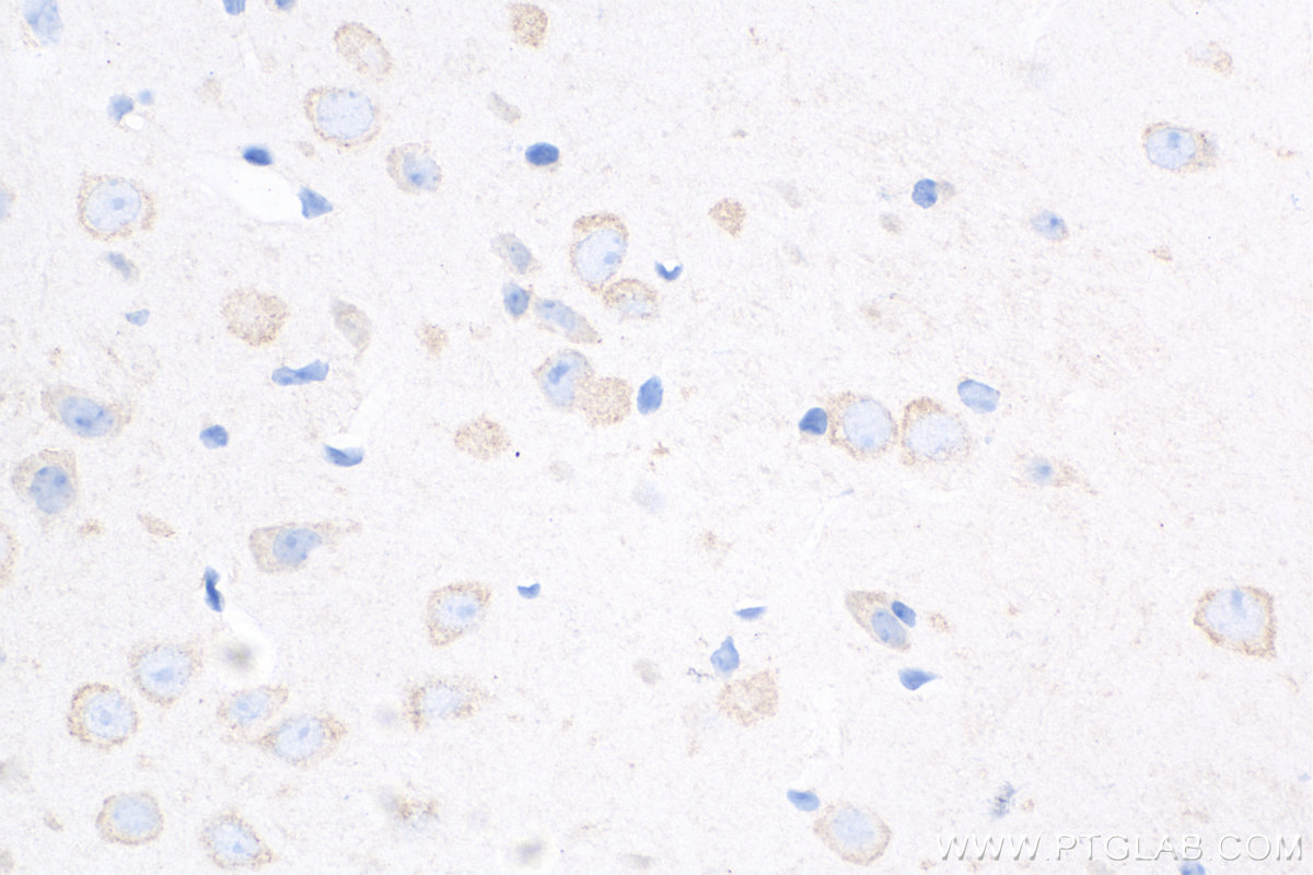 IHC staining of mouse brain using 82202-1-RR