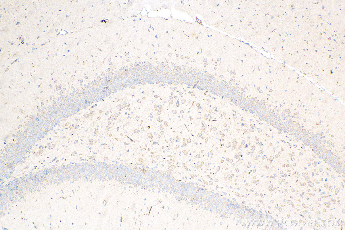 IHC staining of mouse brain using 82202-1-RR
