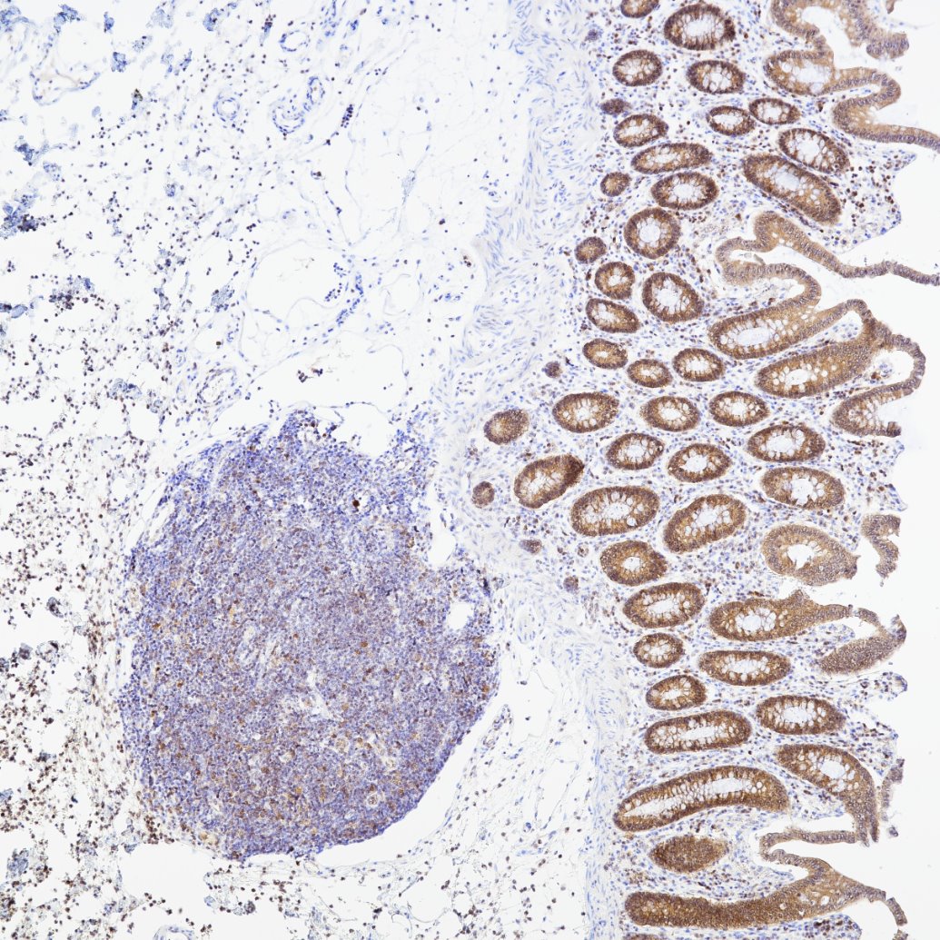 IHC staining of human colon using 82202-1-RR IHC staining of human colon using 82202-1-RR