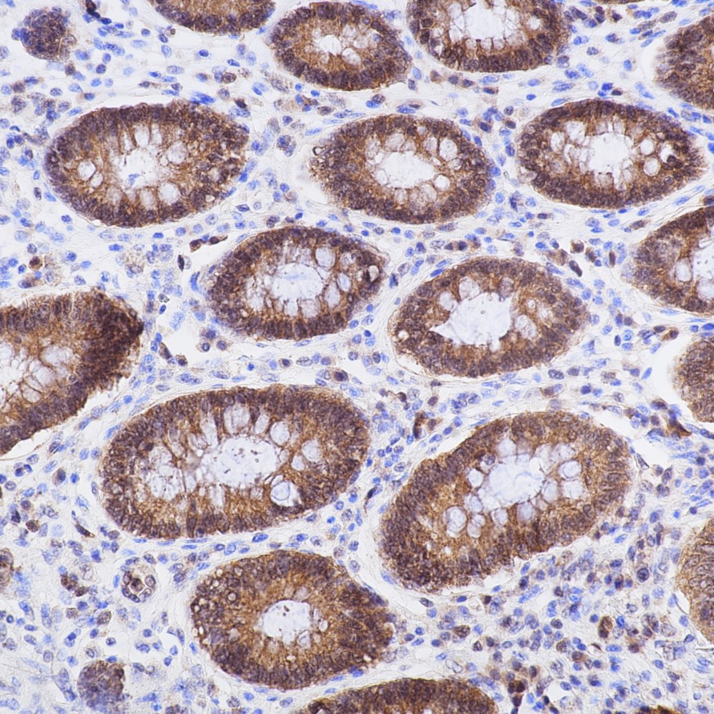 IHC staining of human colon using 82202-1-RR IHC staining of human colon using 82202-1-RR