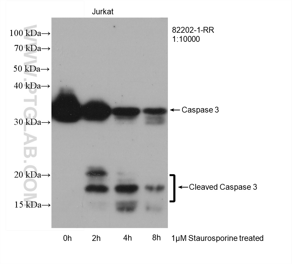 WB analysis of Jurkat using 82202-1-RR (same clone as 82202-1-PBS)