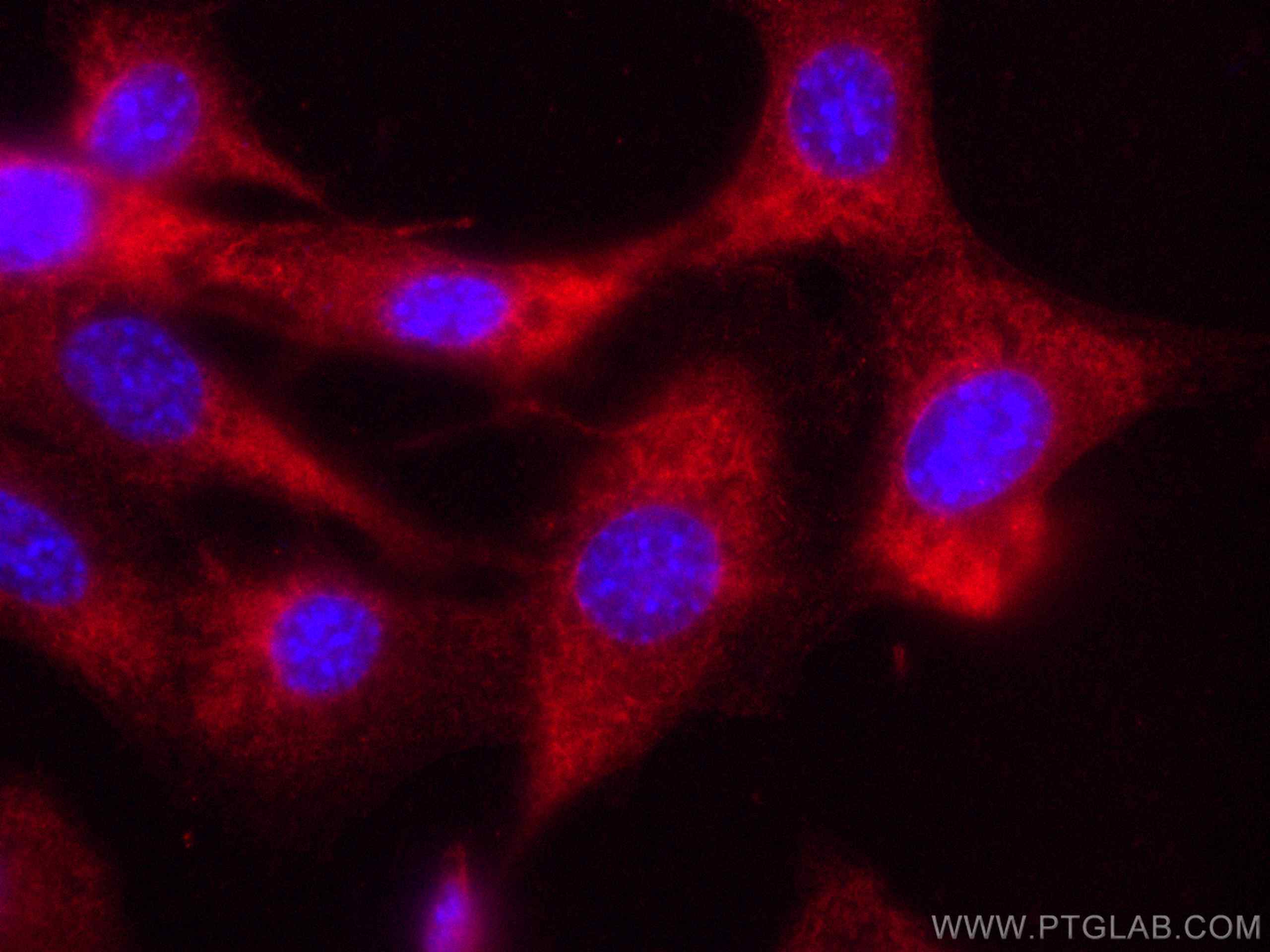 IF Staining of NIH/3T3 using CL594-19677