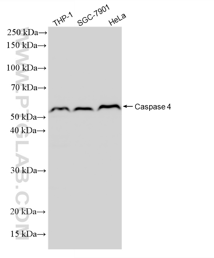 WB analysis using 88257-2-RR (same clone as 88257-2-PBS) WB analysis using 88257-2-RR (same clone as 88257-2-PBS)