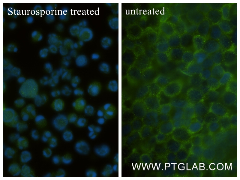IF Staining of Jurkat using 85201-2-RR
