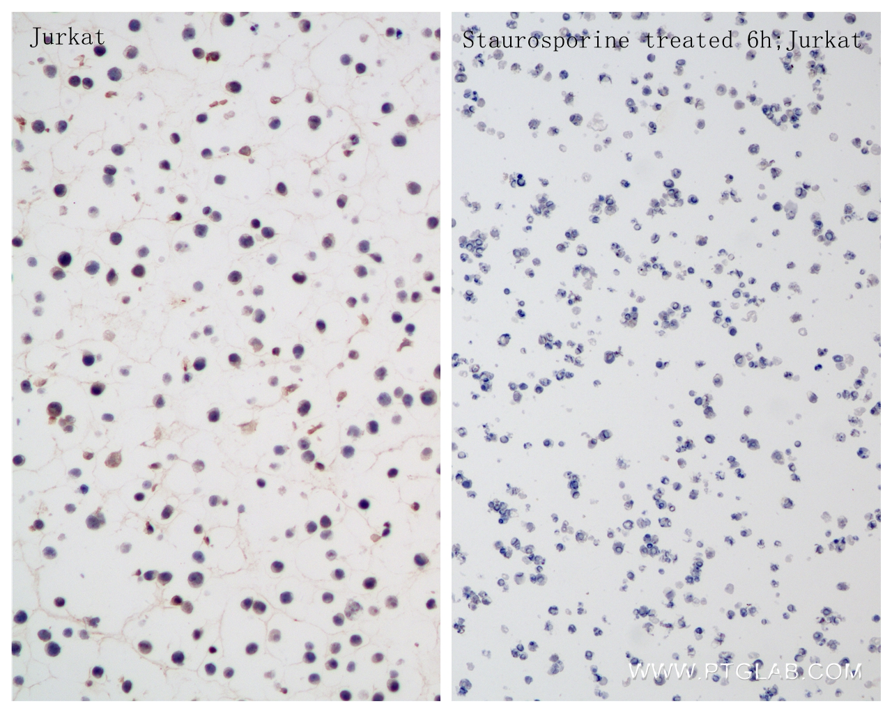 IHC staining of Jurkat using 85201-2-RR