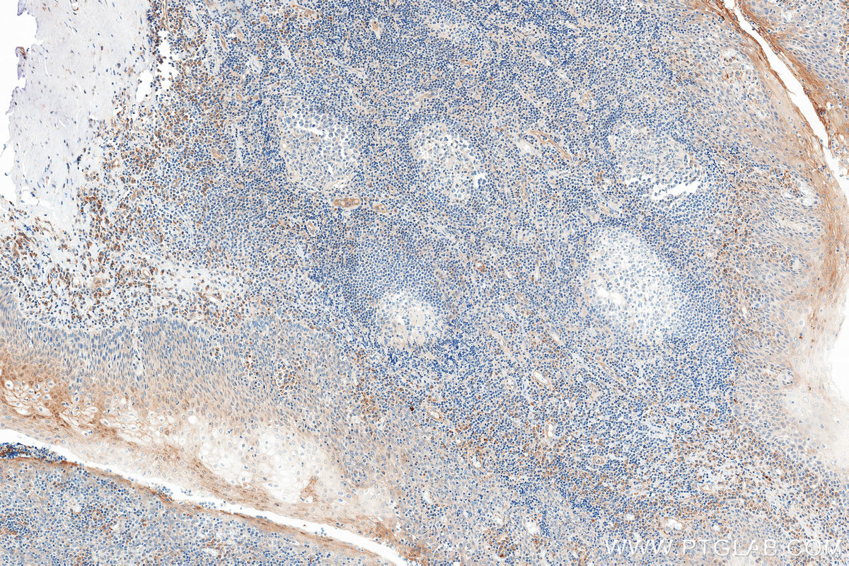 IHC staining of human tonsil using 85201-2-RR (same clone as 85201-2-PBS)