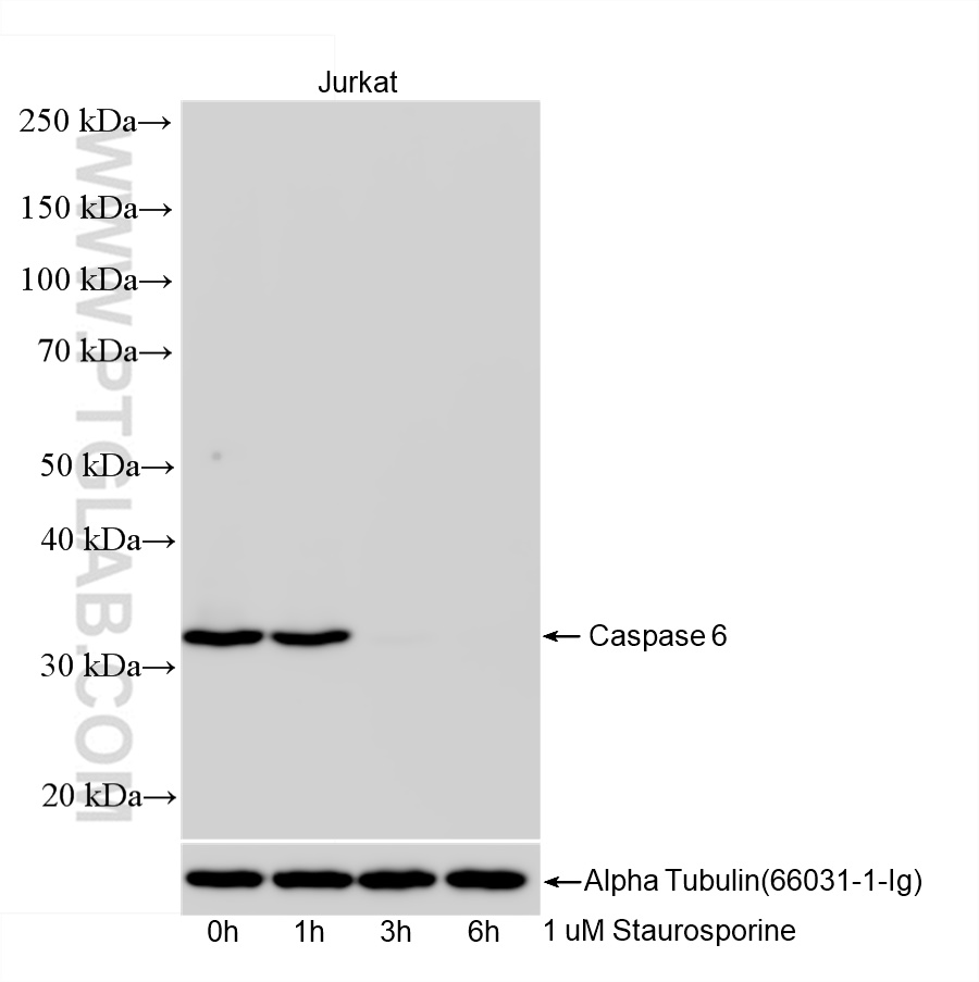 WB analysis of Jurkat using 85201-2-RR (same clone as 85201-2-PBS)
