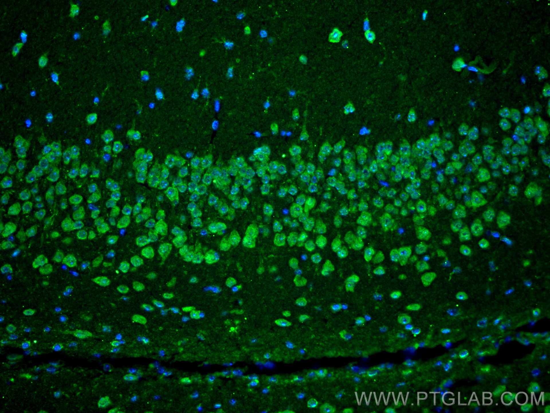 IF Staining of mouse brain using 27155-1-AP