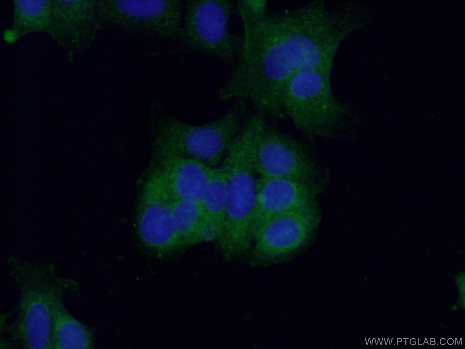 IF Staining of MCF-7 using 27155-1-AP