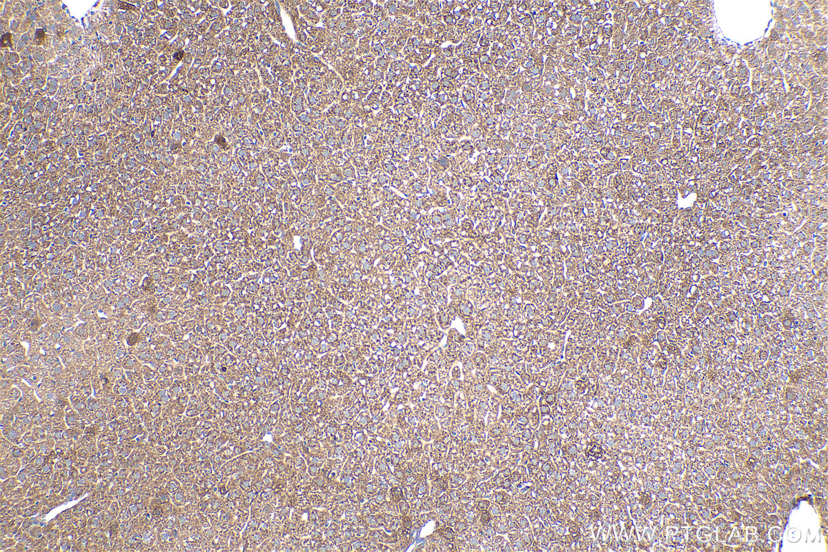 IHC staining of mouse liver using 67956-1-Ig