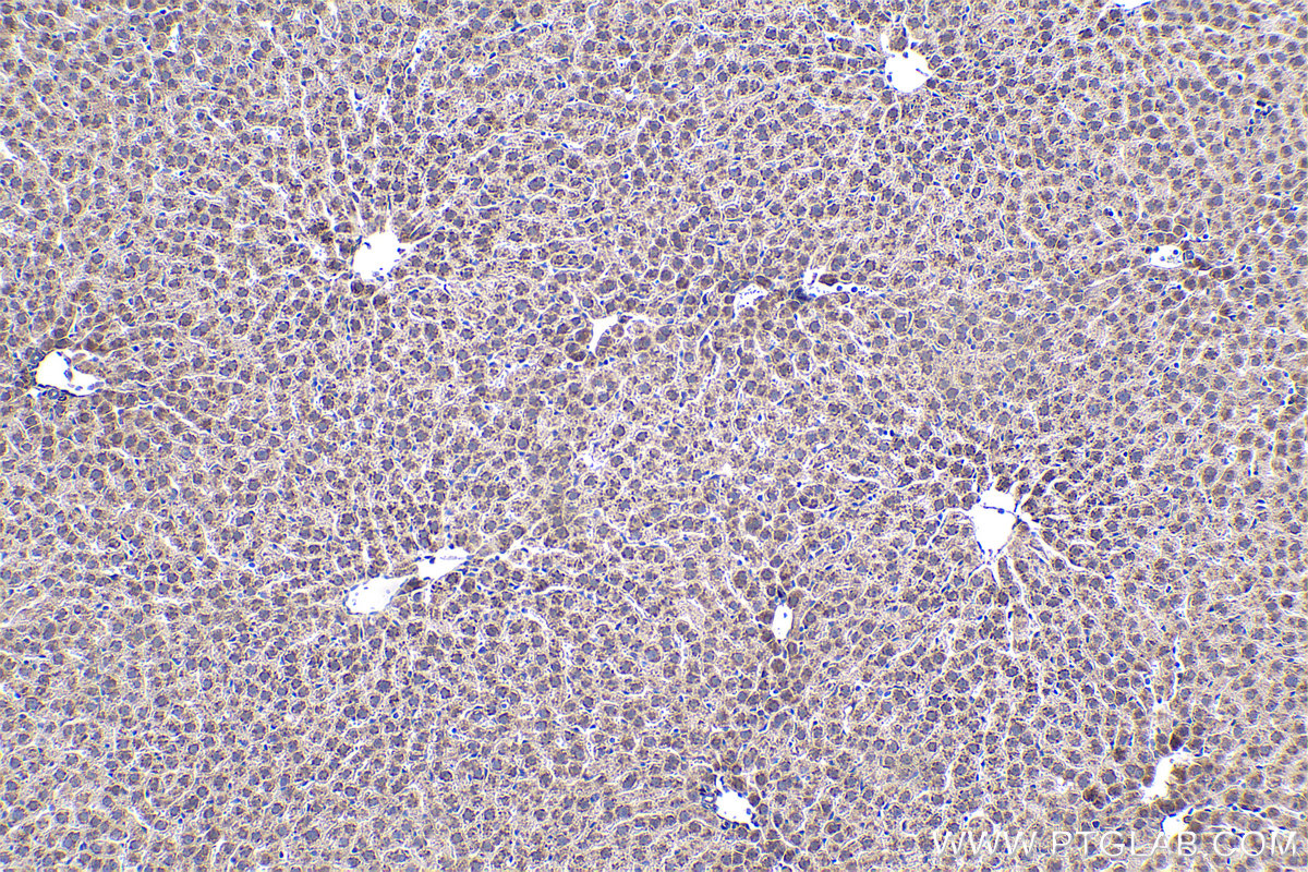 IHC staining of rat liver using 67956-1-Ig