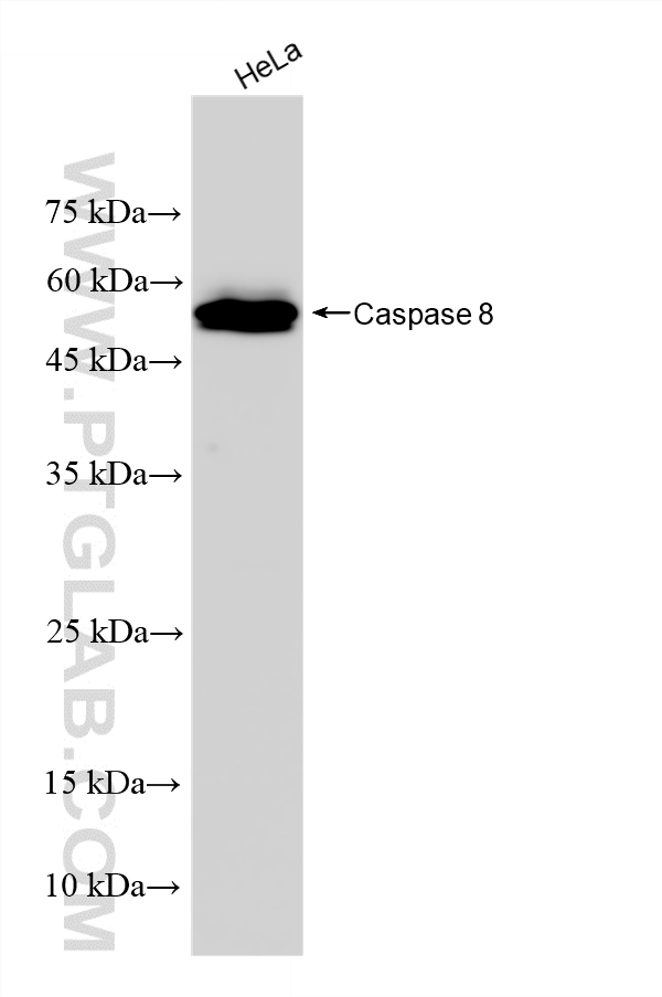 WB analysis using 85329-3-RR (same clone as 85329-3-PBS) WB analysis using 85329-3-RR (same clone as 85329-3-PBS)
